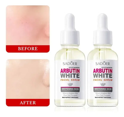 Serum aclarante con arbutina y nicotinamida SADOER
