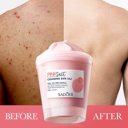 Exfoliante sal rosa del Himalaya con 18% de centella pura SADOER
