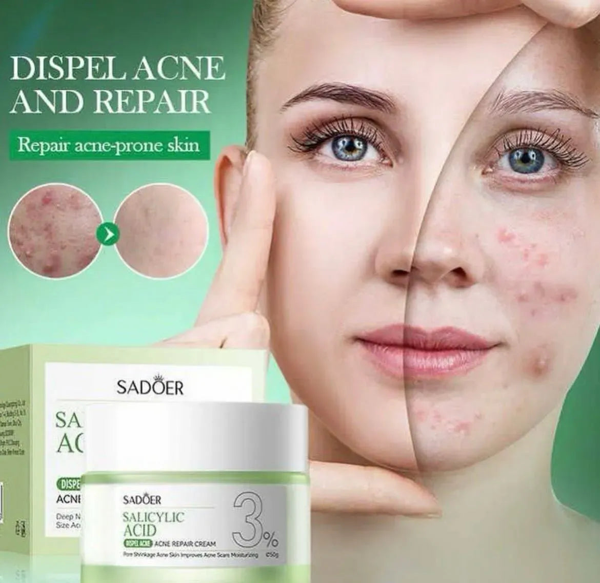 crema acido salicilico con centella asiatica y niacinamida SADOER